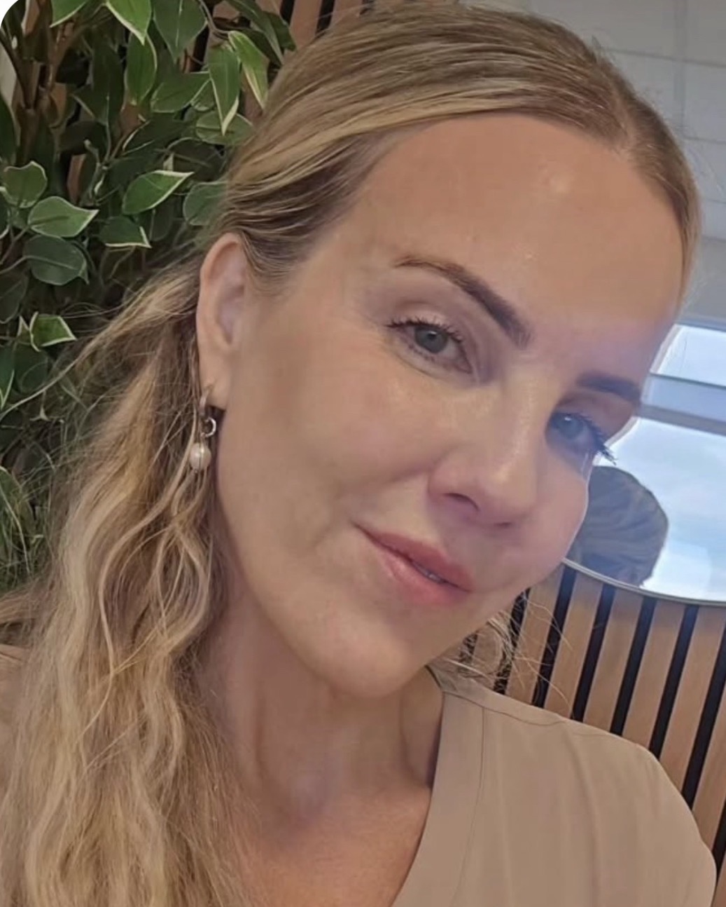 Jóhanna Lind, hjúkrunarfræðingur hjá SkinPro